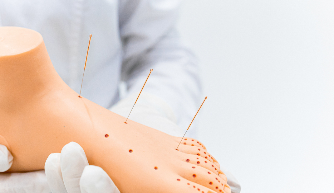 Zhi Zhen Tang TCM & Acupuncture