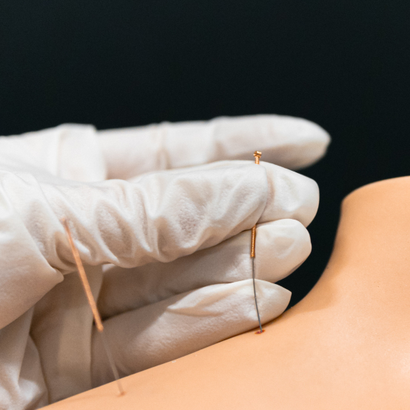 Zhi Zhen Tang TCM & Acupuncture