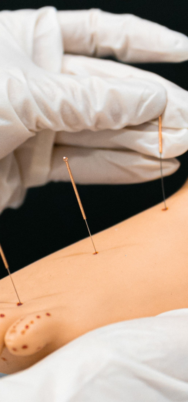 Zhi Zhen Tang TCM & Acupuncture
